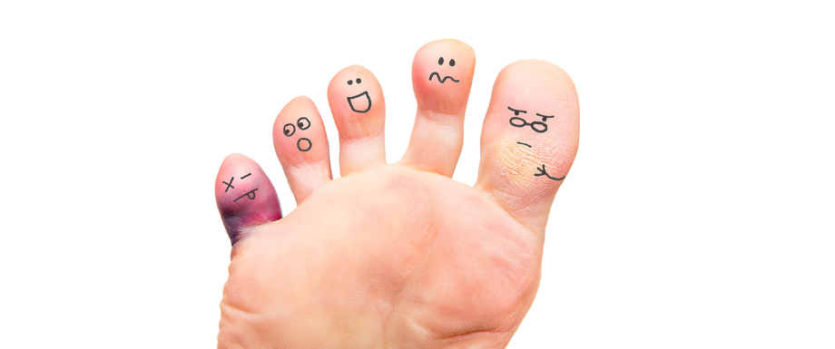 Diabetes and Feet – Hammertoe